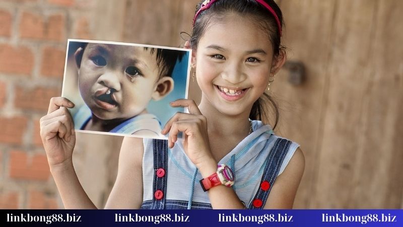 Quỹ Nụ Cười Trẻ Thơ - Sự kiện mang tính nhân văn sâu sắc 1 Quỹ Nụ Cười Trẻ Thơ tài trợ phẫu thuật 100%